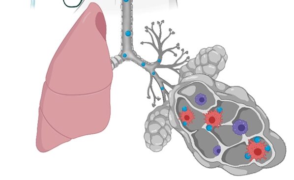 A biologic drug for the treatment of chronic obstructive pulmonary disease